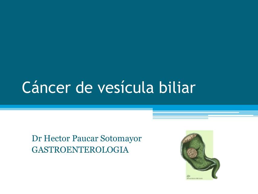 Cáncer de vesícula biliar