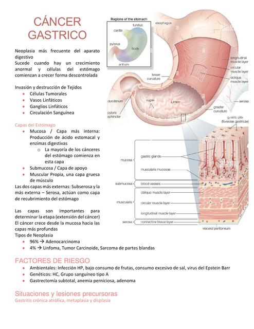 Cáncer Gástrico Raven Udocz