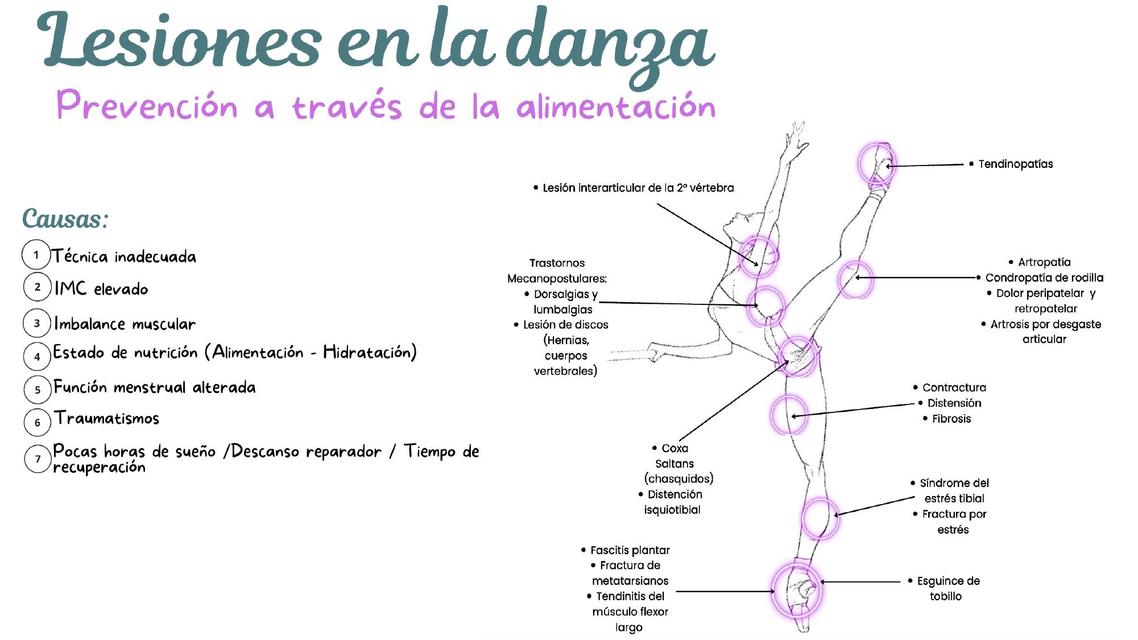 lesiones en la danza