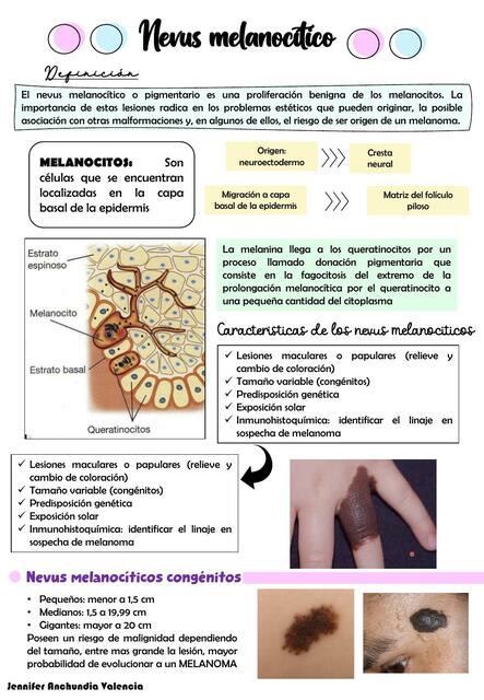 Nevus melanociticos y melanoma