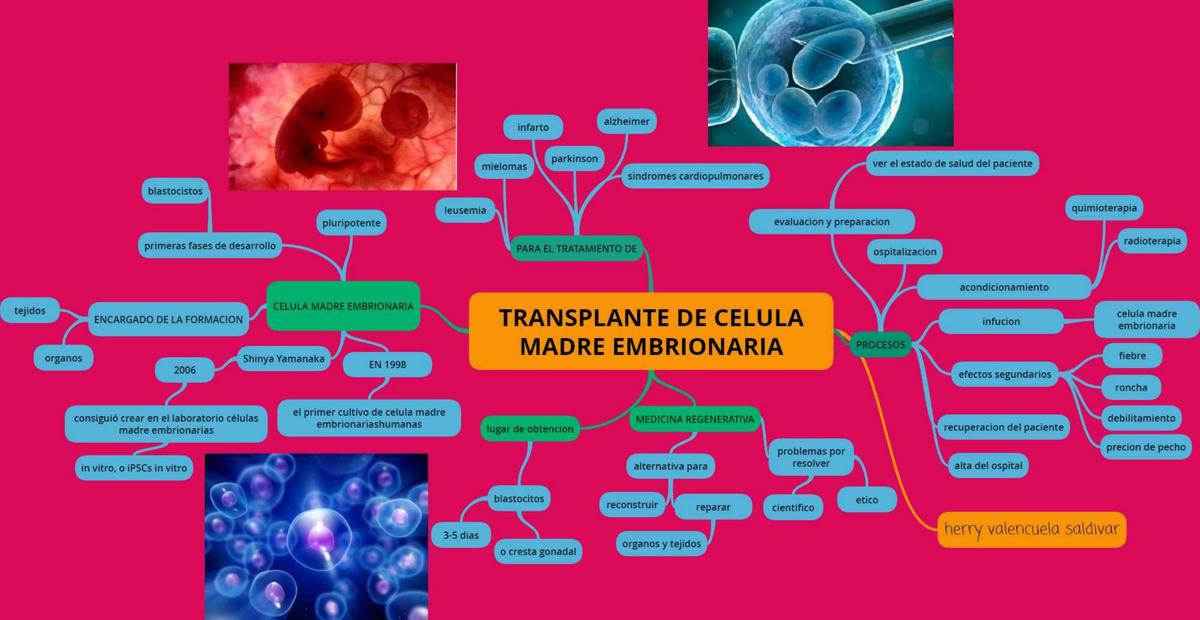 Transplante de Célula Madre Embrionaria 