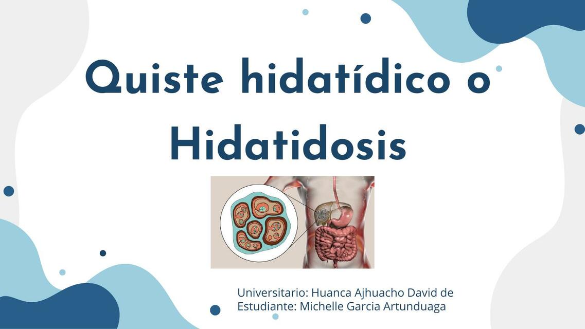 Hidatidosis