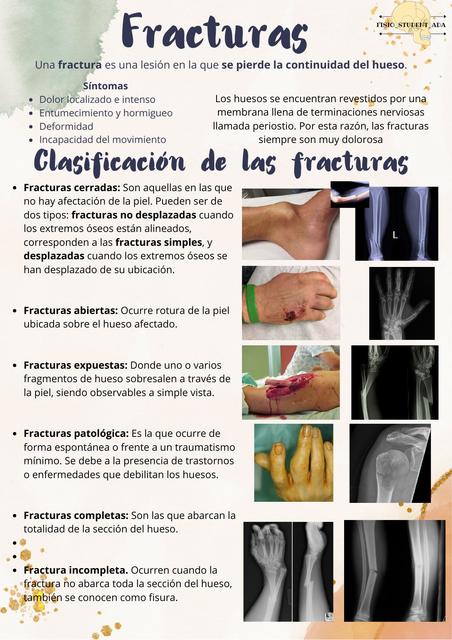 Fracturas Fisio Ada Udocz Fracturas Fisio Ada Udocz