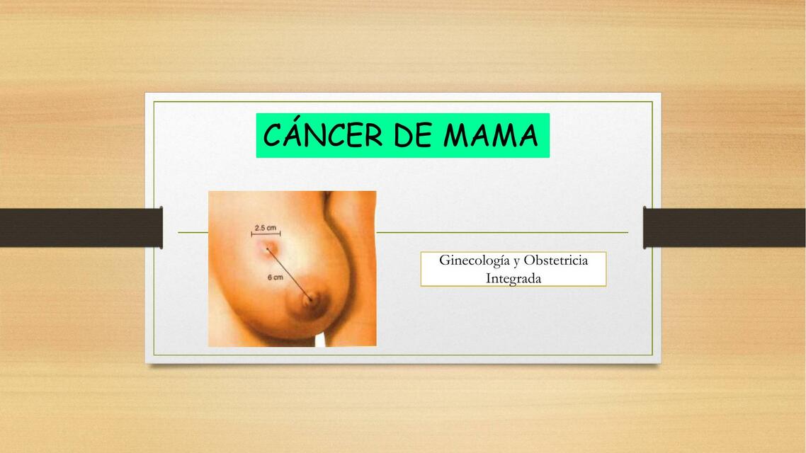 Cáncer de mama