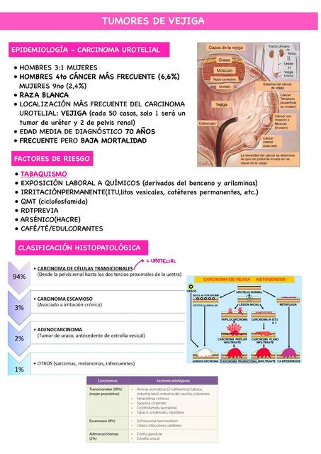 Tumores de Vejiga