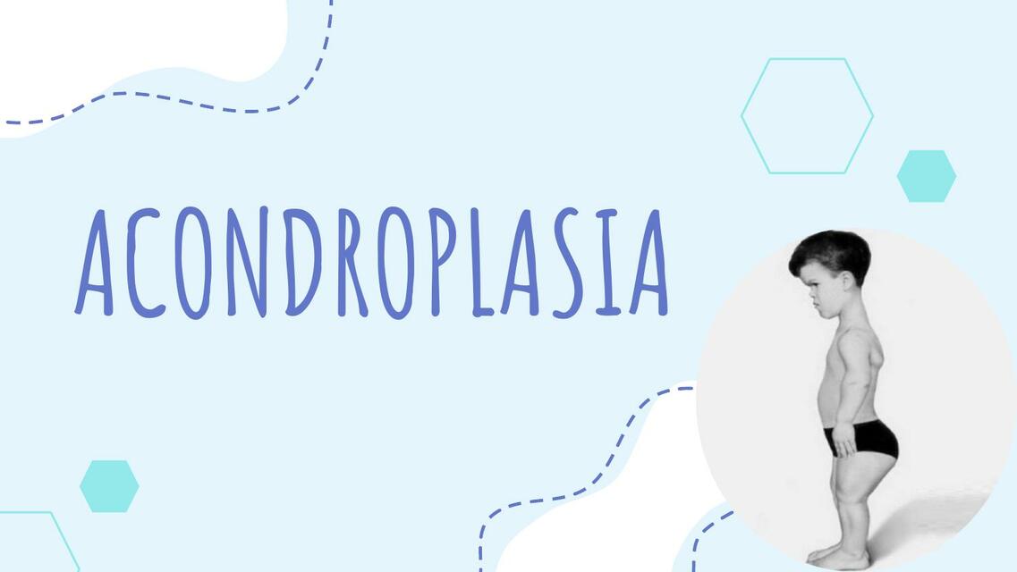 Acondroplasia 