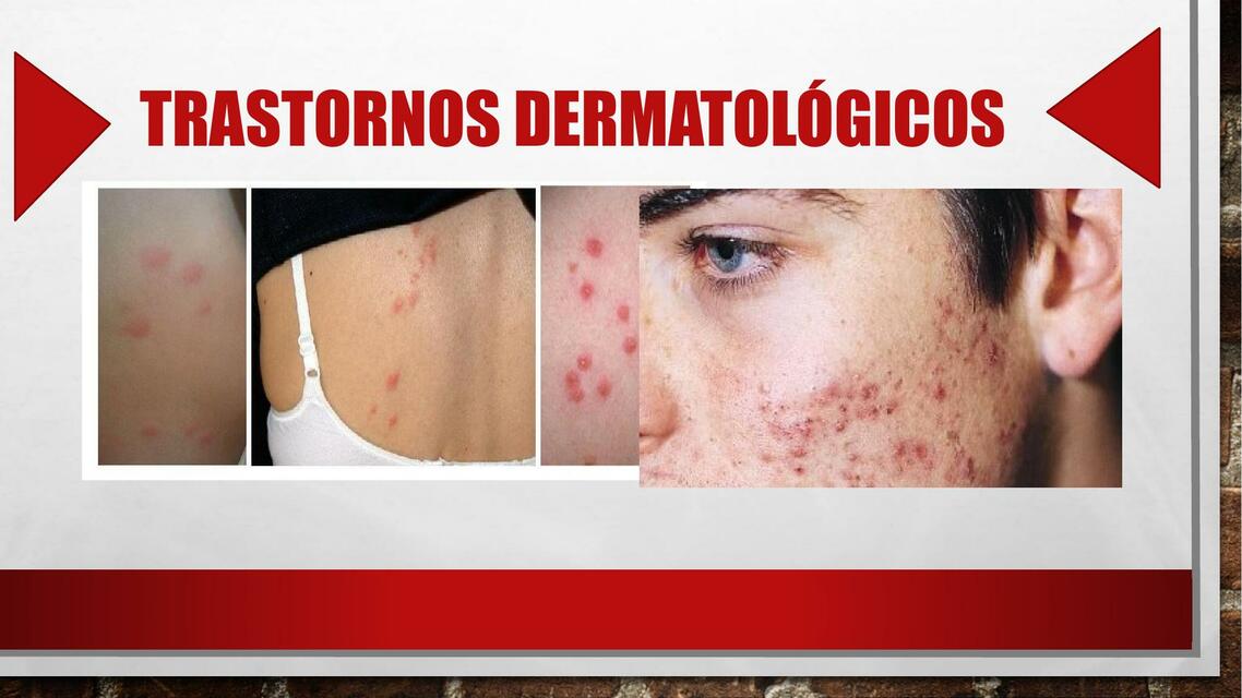 Trastornos Dermatológicos 