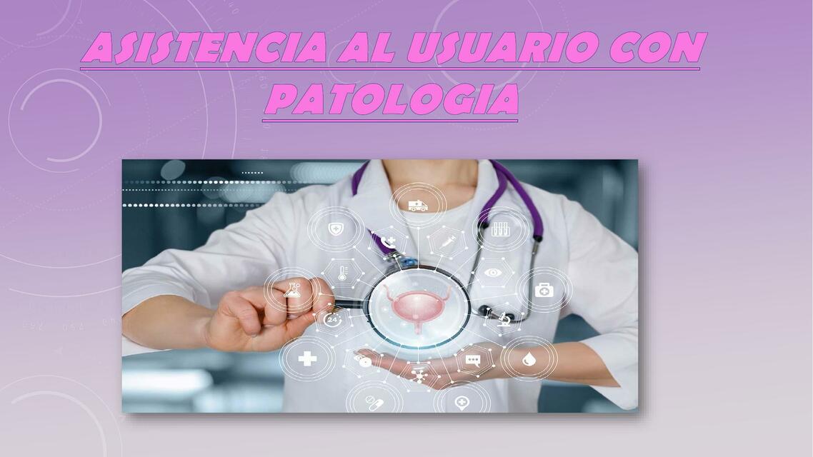 Patologías del Glaucoma