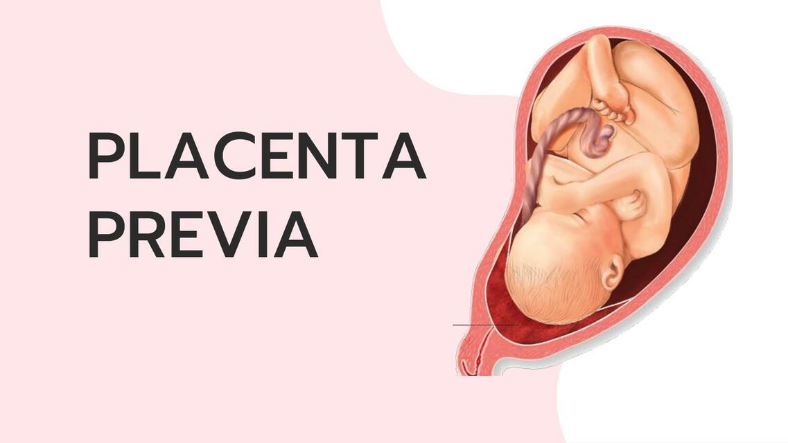 Placenta previa