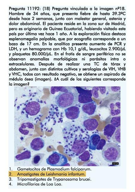 Ciclo vitale del tripanosoma brucei