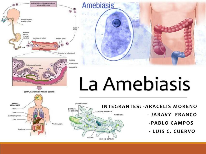 Amebiasis Medilove Udocz 6140