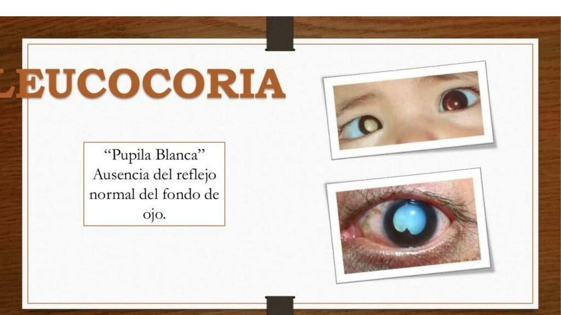 Leucocoria