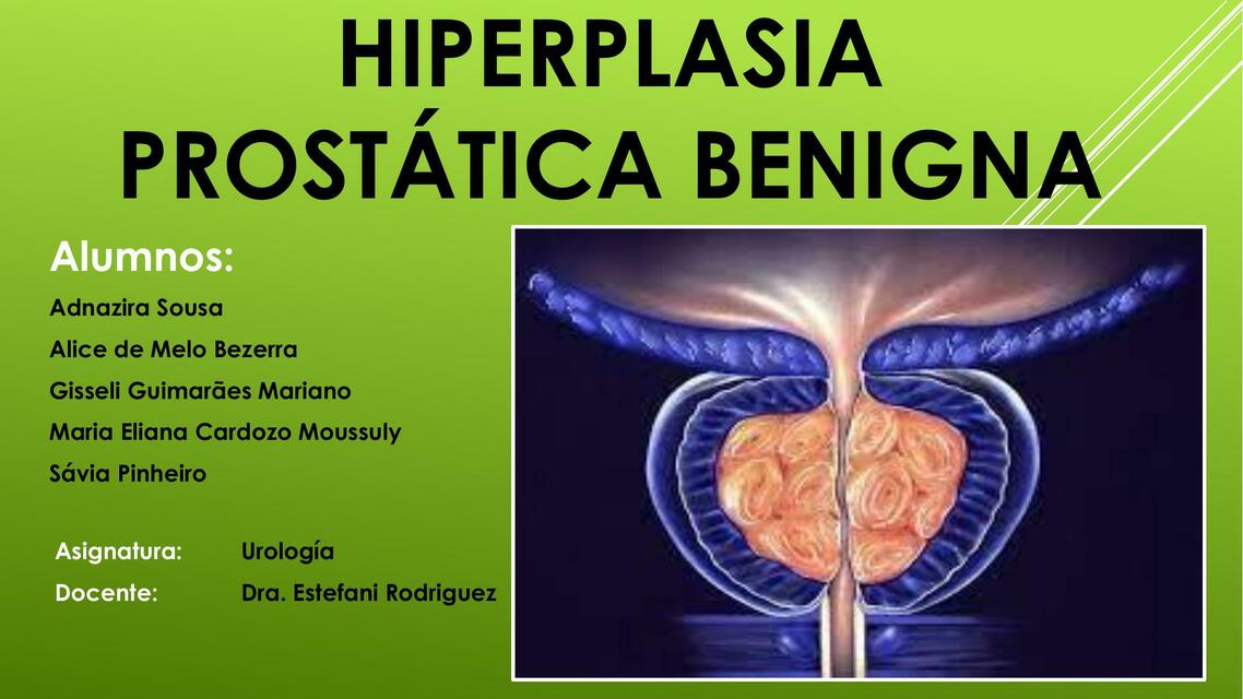 Hiperplasia Prostática Benigna 