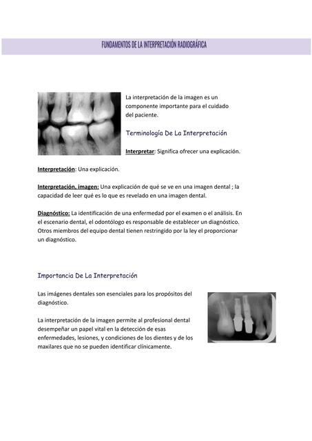 Fundamentos de la Interpretación Radiográfica 