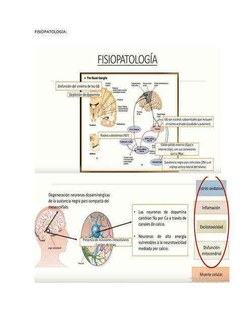 Parkinson