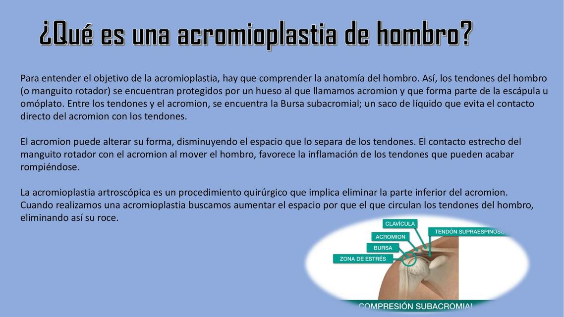 Acromioplastia de hombro