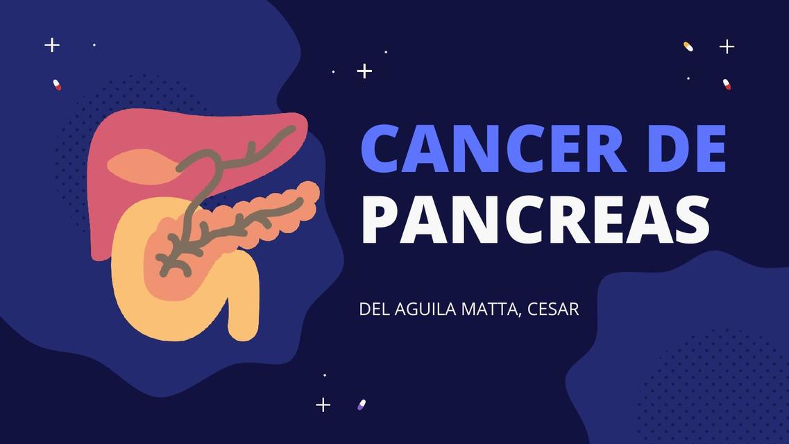 Resúmenes de Cáncer de páncreas | Descarga apuntes de Cáncer de páncreas