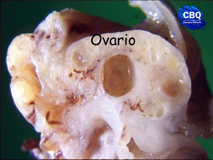 Ovario