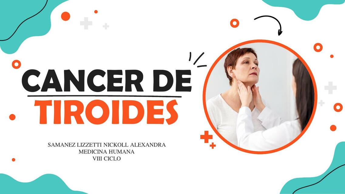 Cáncer de tiroides 