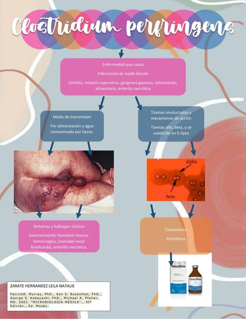 Clostridium perfringens puntos importantes