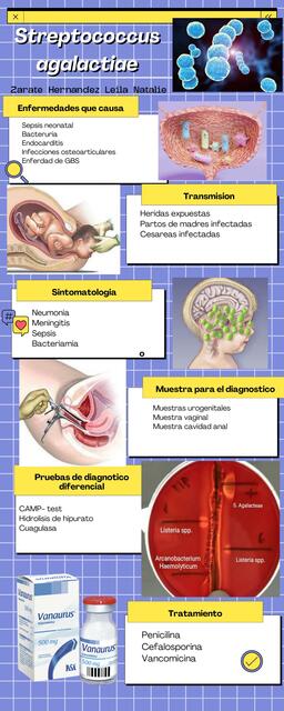 Streptococcus agalactiae infografia informativa