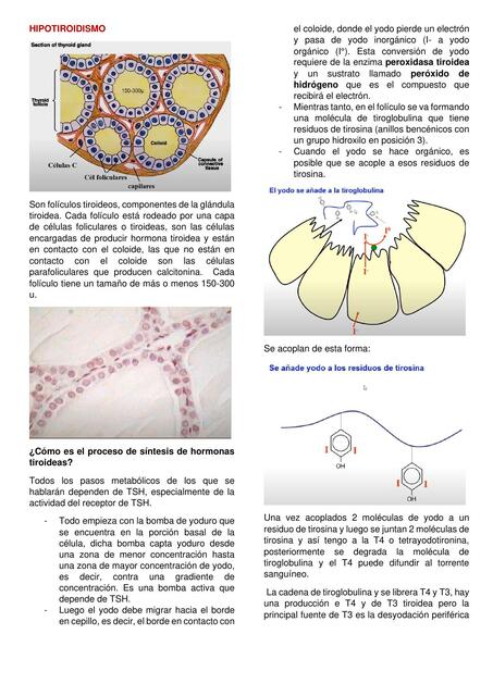 Alteraciones de Tiroides y Paratiroides 