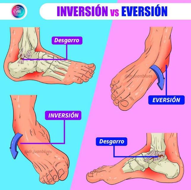 Inversi n vs eversi n yudoc org udocz