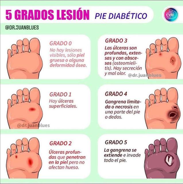 Pie Diabético uDocz