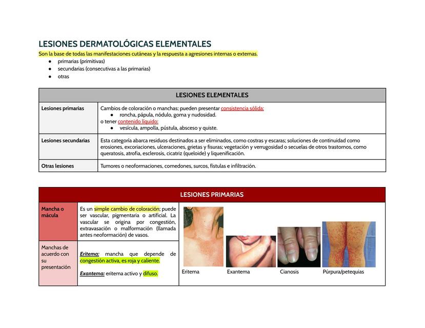 Lesiones Dermatológicas Elementales