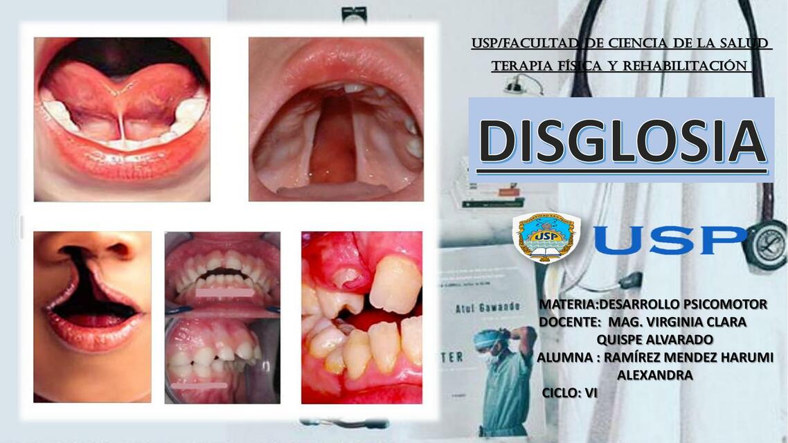 Dislogia