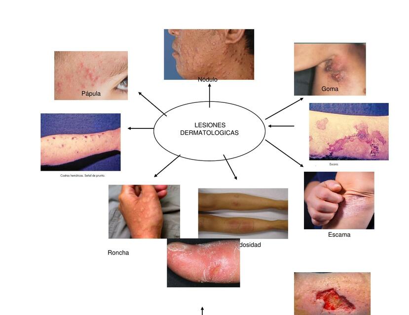 Mapa Mental Dermatitis