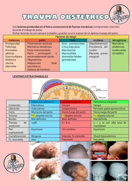 Trauma obstétrico 