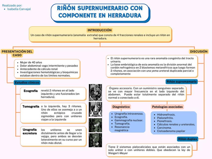 Riñón supernumerario