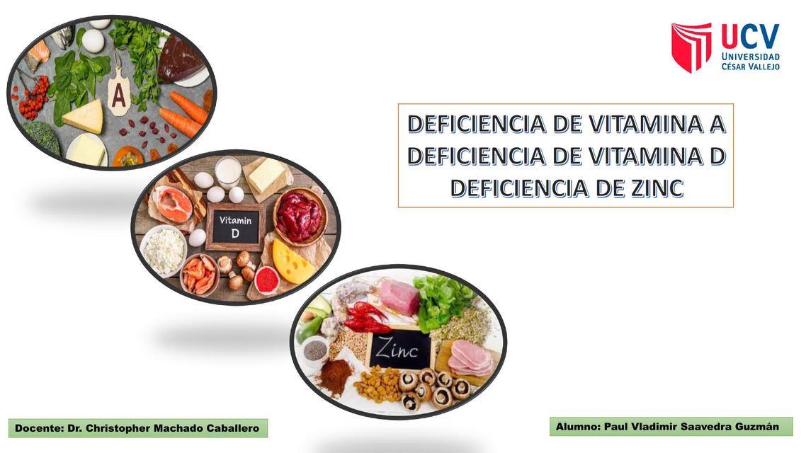 Deficiencia de Vitamina A, D y Zinc