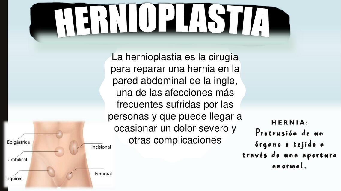 Hernioplastia 