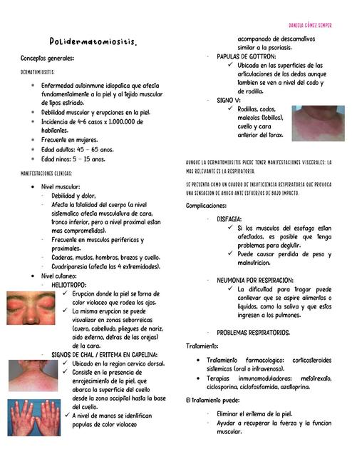 Polidermatomiositis