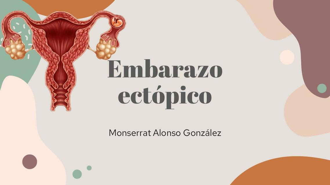 Embarazo ectópico