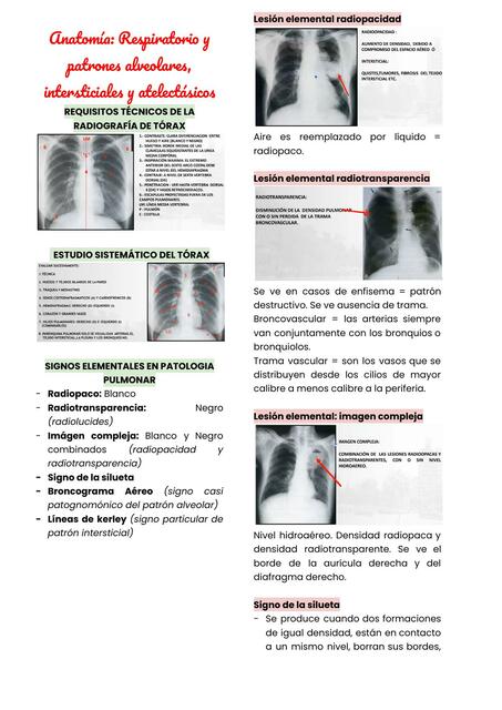 Respiratorio y Patrones Alveolares, Intersticiales y Atelectásicos