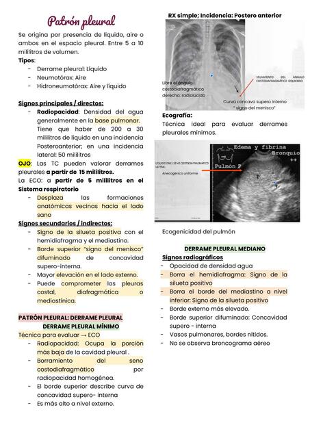 Patrones pleurales, vascular, nodular - masa y destructivo.