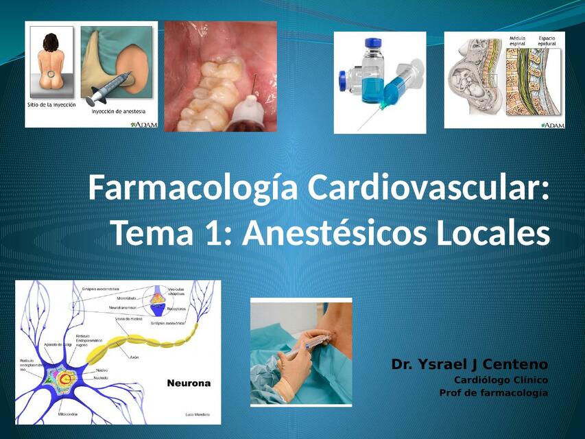 Anestésicos locales