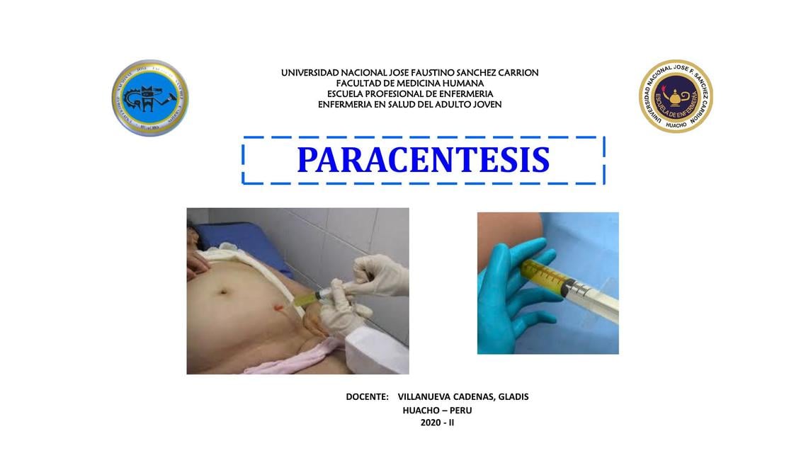Cirrosis hepática paracentesis | BARRÓN MARTINEZ JENNIFER | uDocz