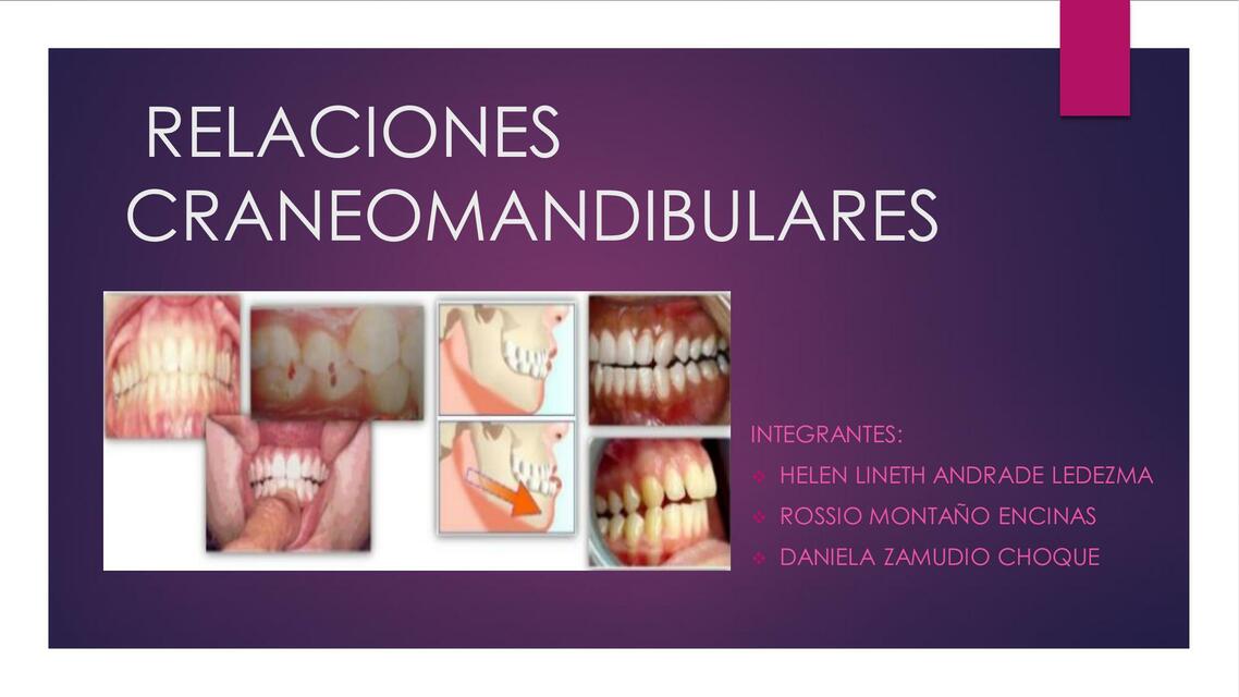 Relaciones Craneomandibulares 