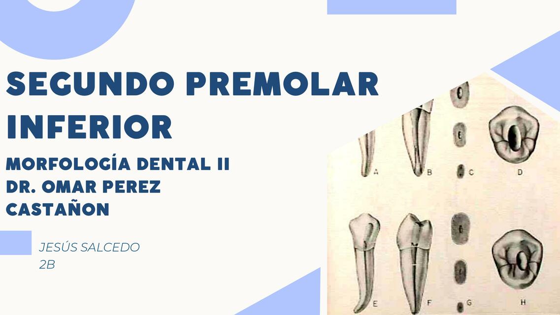 Segundo Premolar Inferior 