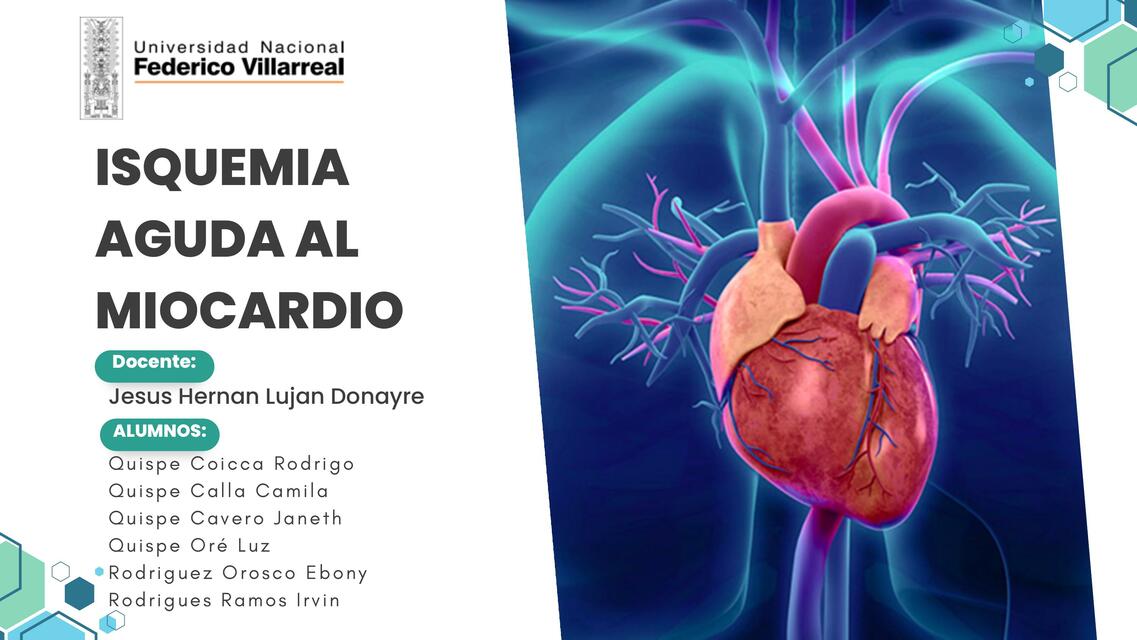 Isquemia Aguda del Miocardio 