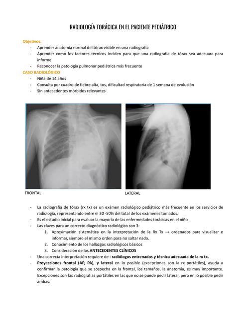 Radiología Torácica En Pediatría