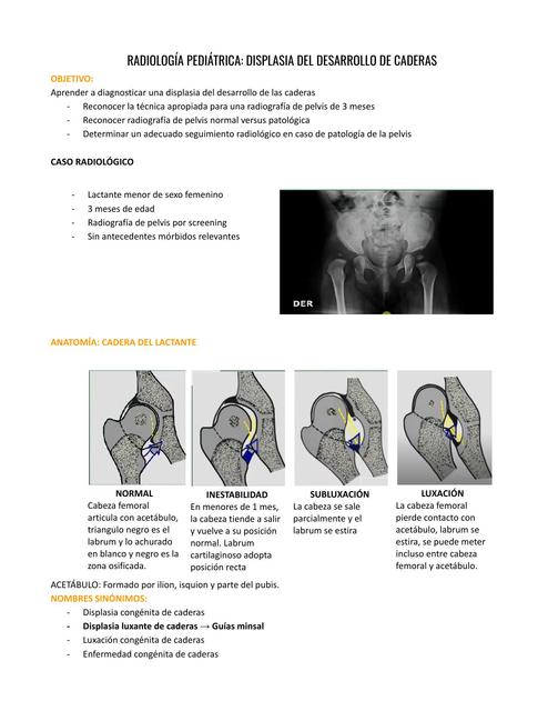 Displasia De Caderas