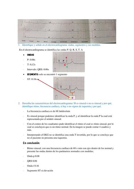 Electrocardiograma