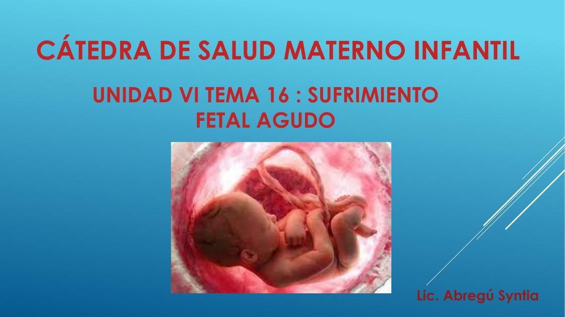 Sufrimiento fetal 