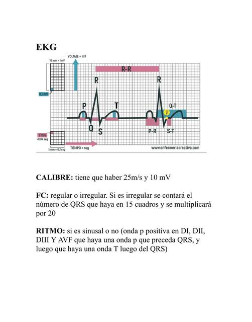 EKG 