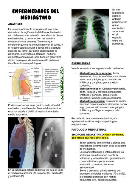 Enfermedades del Mediastino 